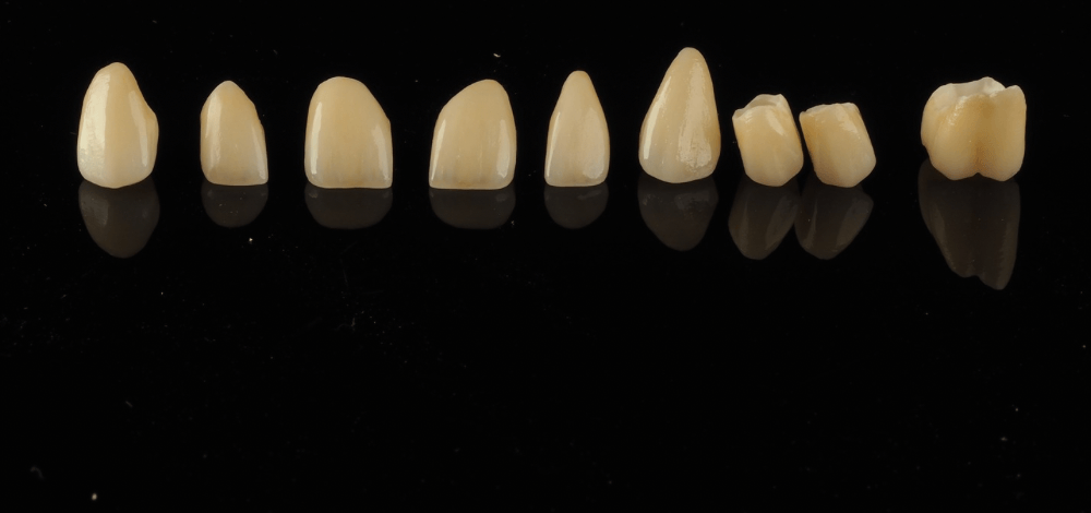 korony cyrkonowe licowane porcelaną