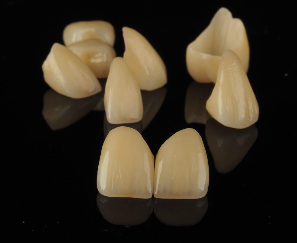 korony cyrkonowe licowane porcelana