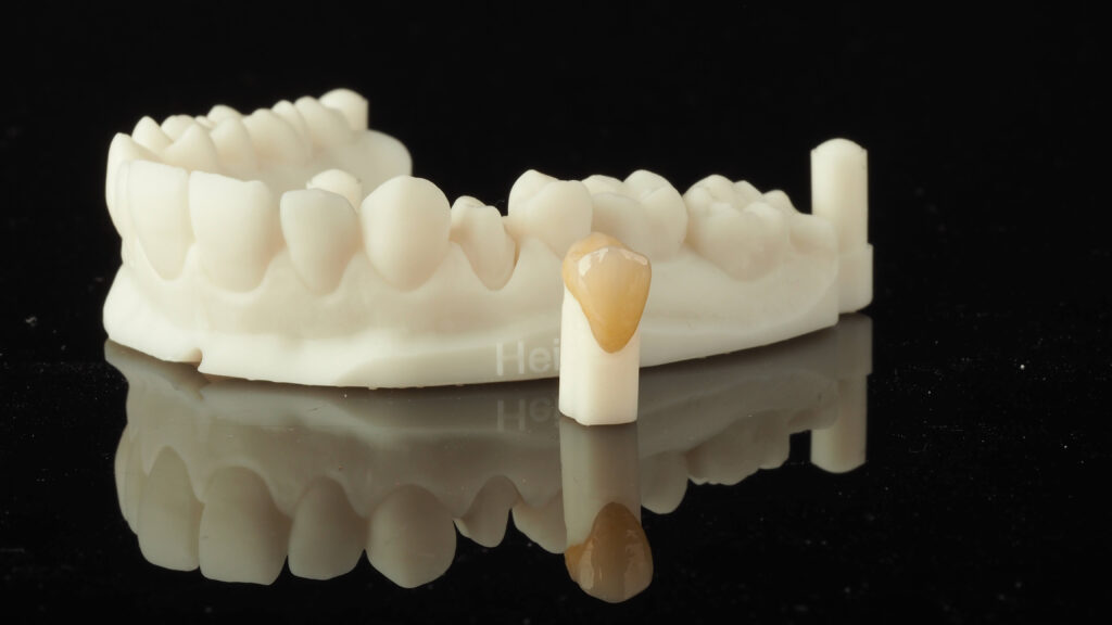 korona cyrkonowa exacto lab