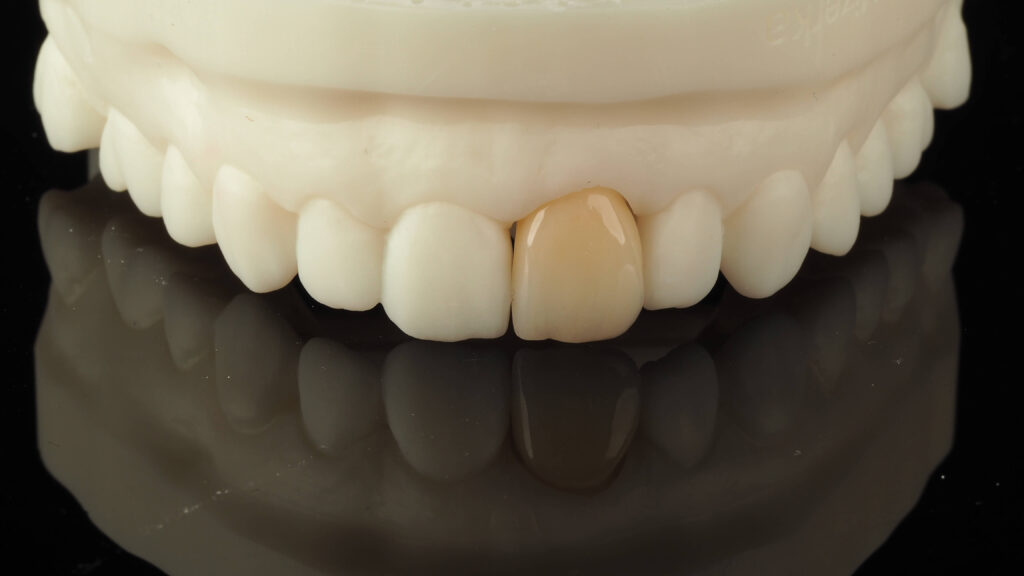 korony cyrkonowe exacto lab cennik