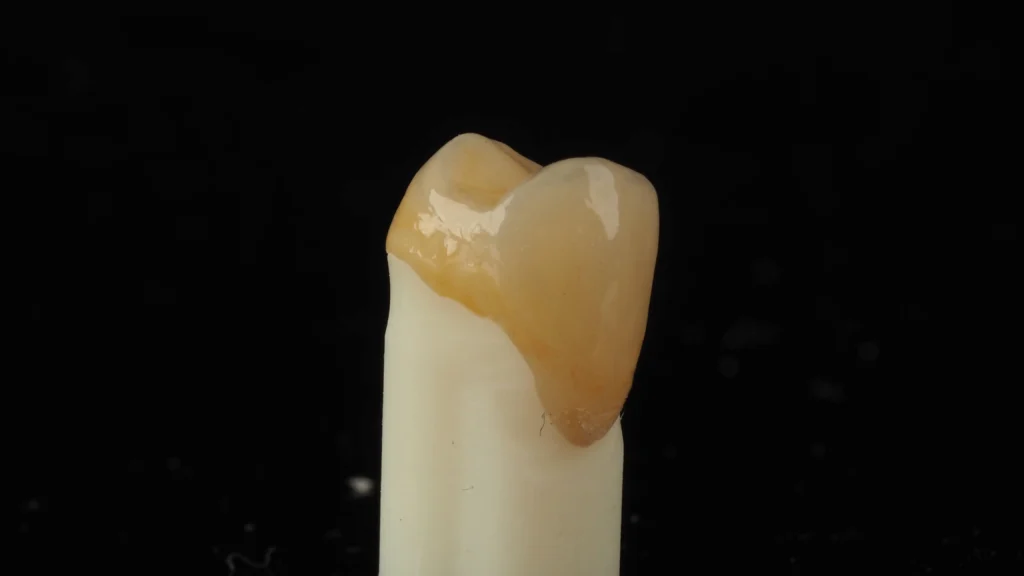 korony cyrkonowe na ile lat