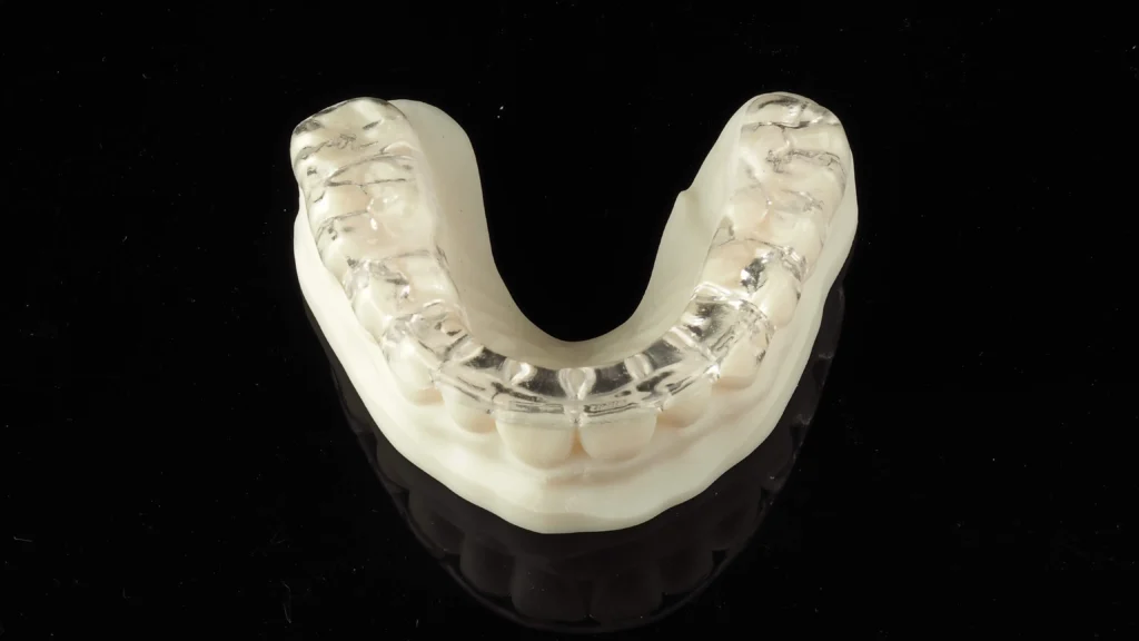 Szyna relaksacyjna — wsparcie w leczeniu bruksizmu