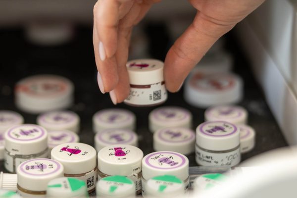 protezy na implantach wykonane są z różnych materiałów, w zależności od potrzeb pacjenta