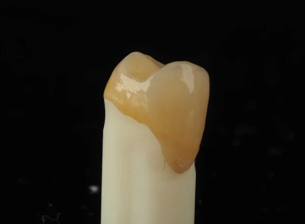 korony cyrkonowe na ile lat